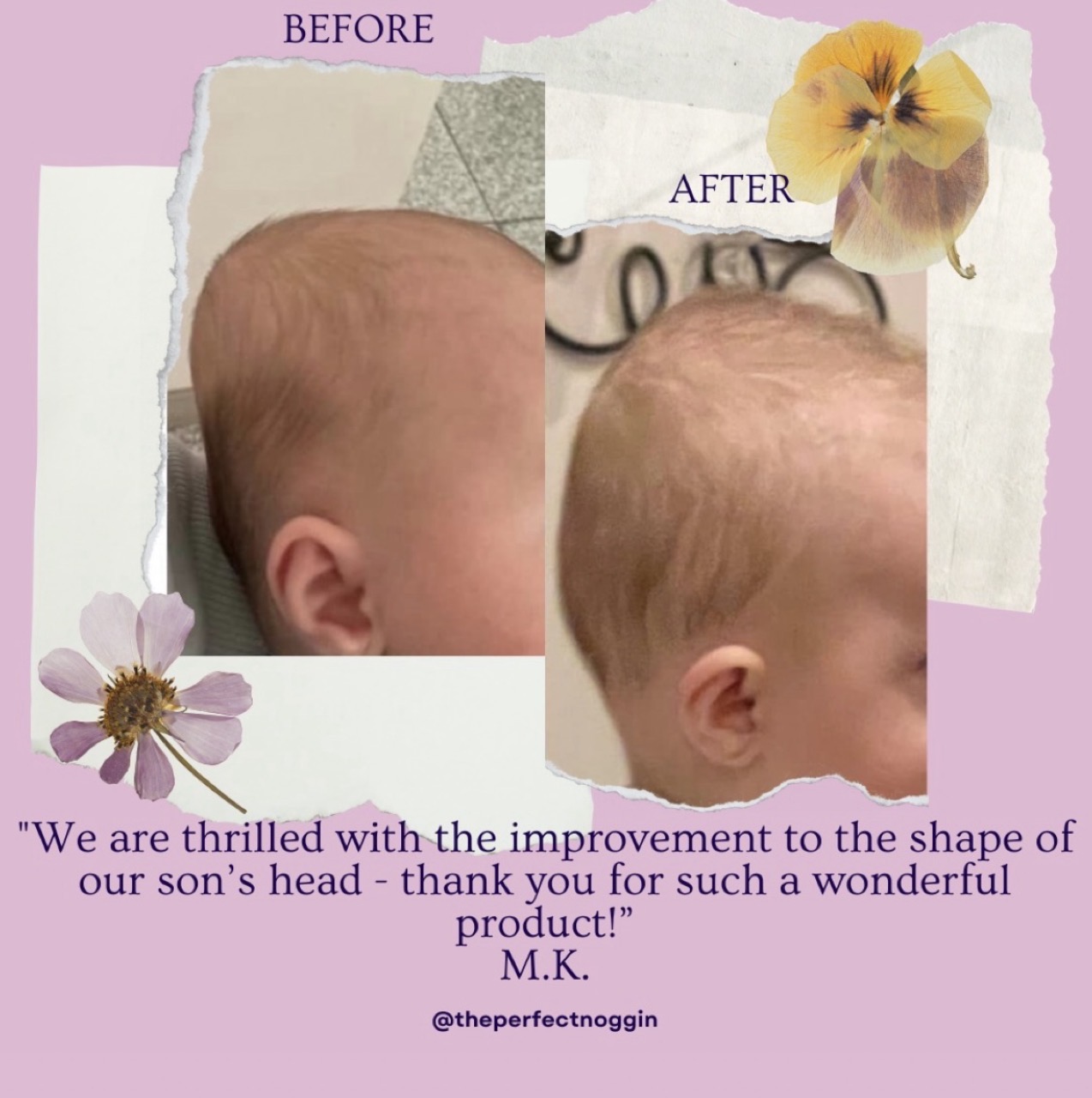 An Instagram ad for a “baby head shaper”