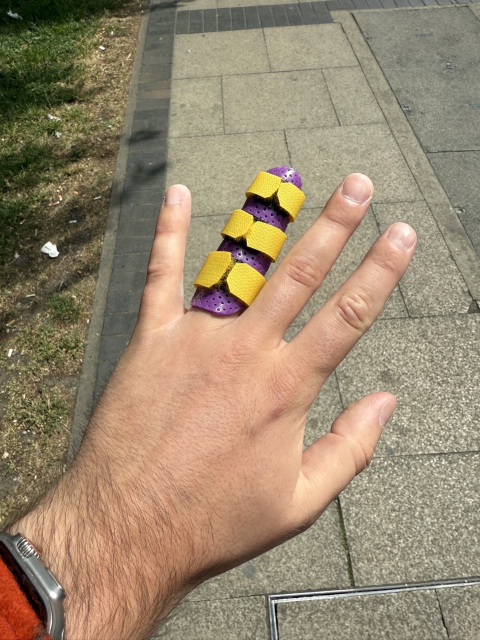 My finger in a purple and yellow splint